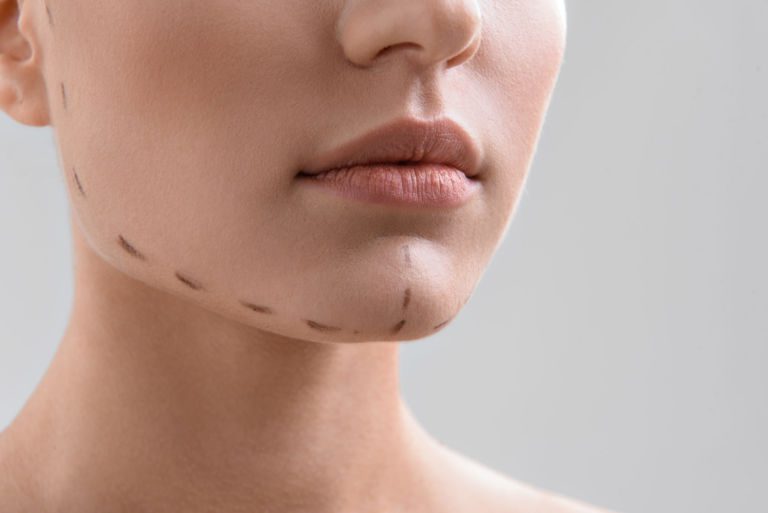 Young woman preparing for plastic facial operation